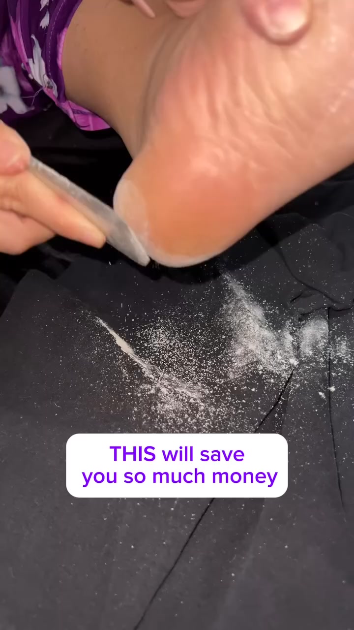 Heal Your Heels