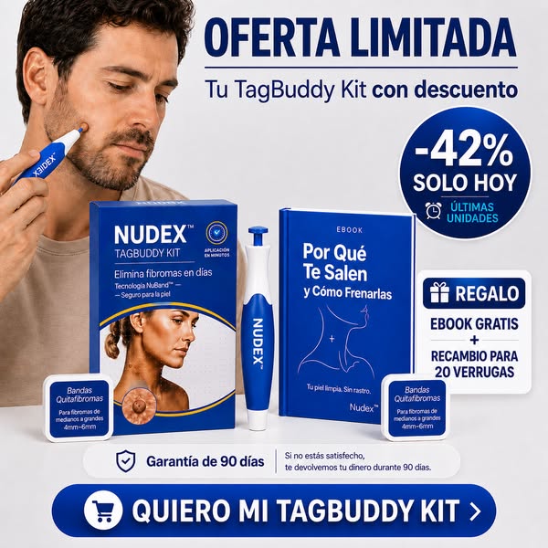 Envío gratis a España · 90 días de garantía