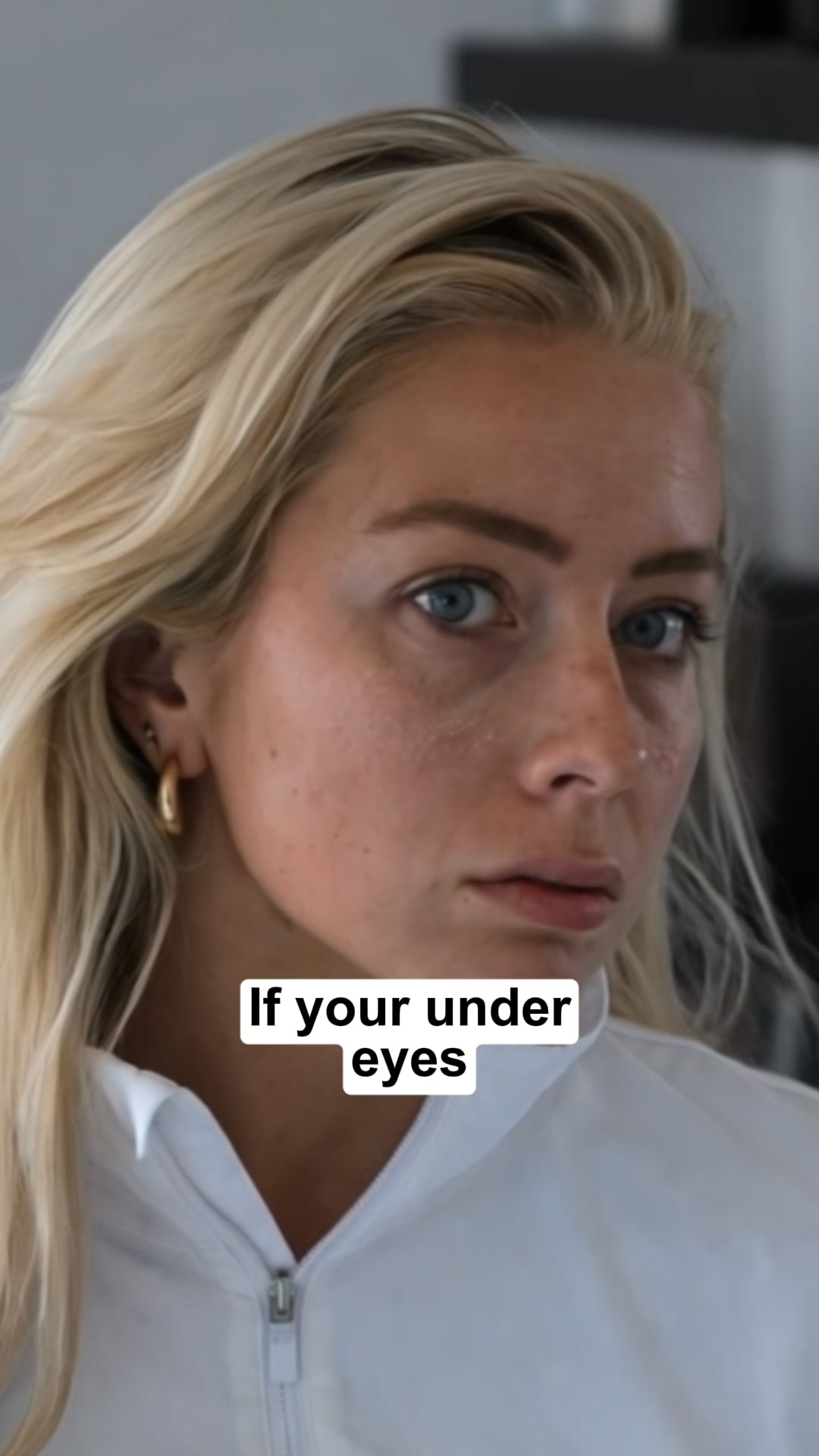 Dry-under eyes? (apply this for 7 days)