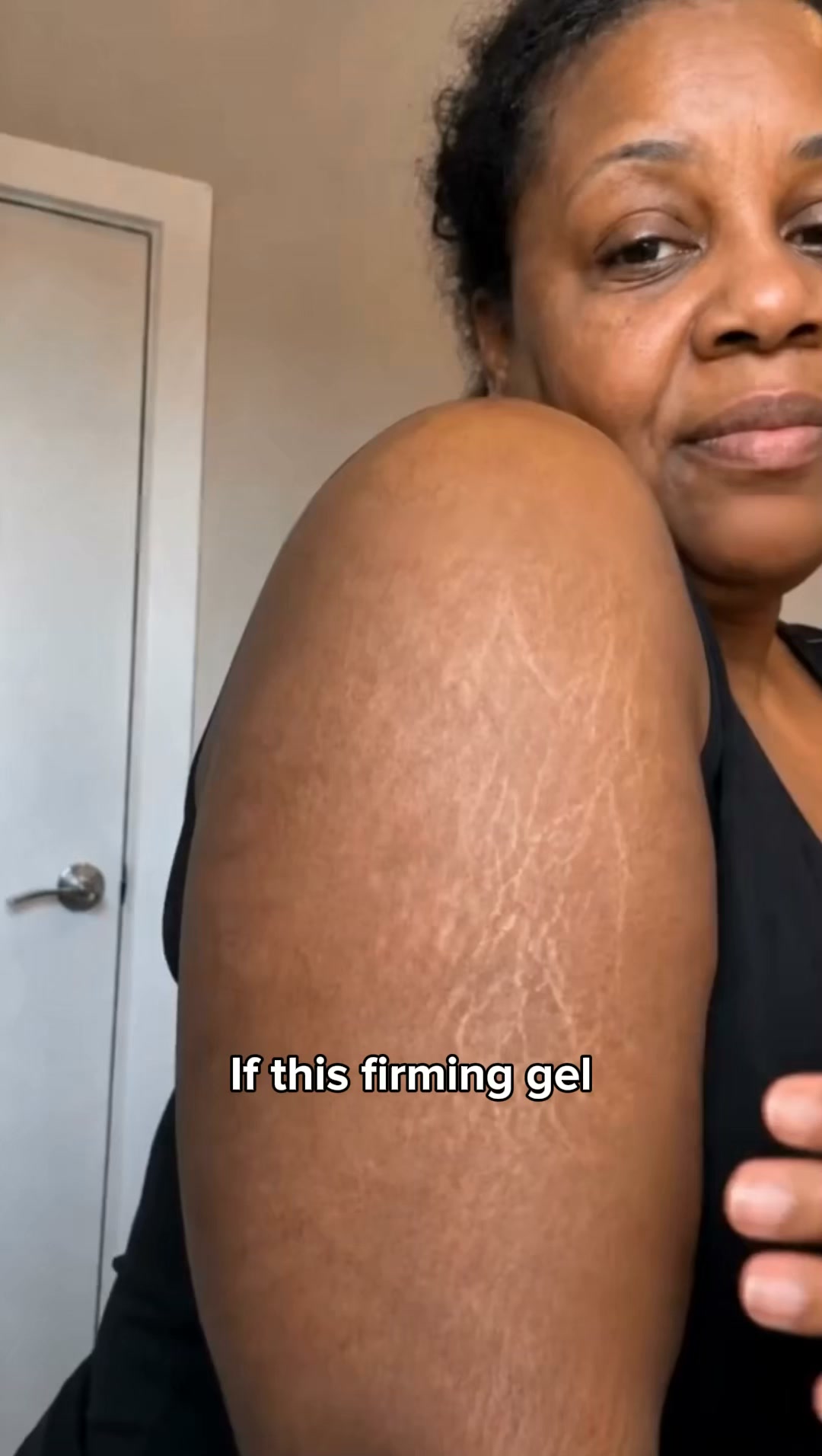 Hollywood's Secret to Tighter, Cellulite-Free Skin