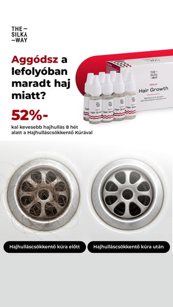 Állítsd meg a hajhullást 8 hét alatt!