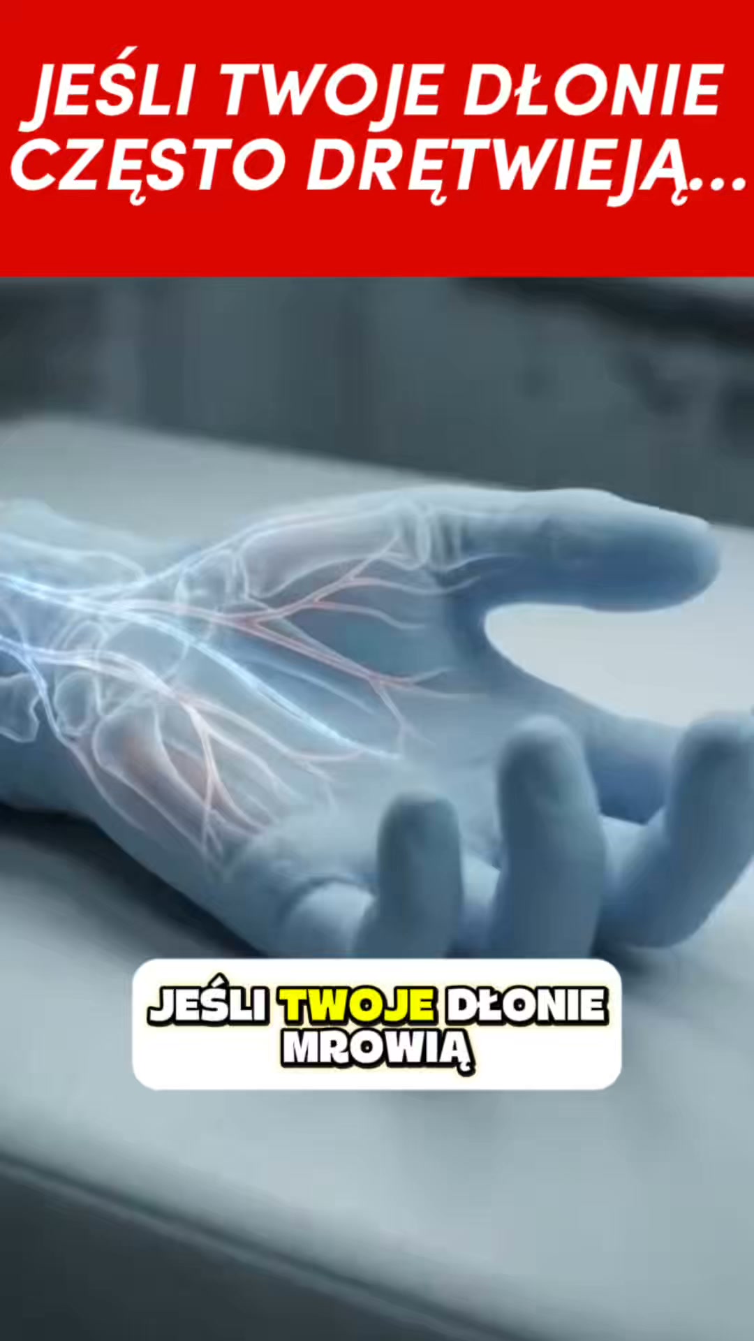 NOWOŚĆ: Ulga przy cieśni nadgarstka