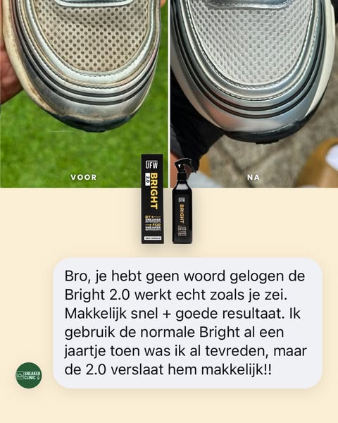 De beste schoenenreiniger voor jouw collectie