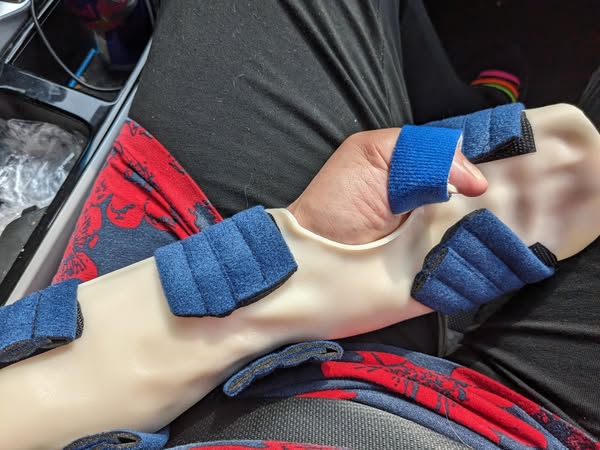 Why Most Stroke Survivors Stop Getting Better