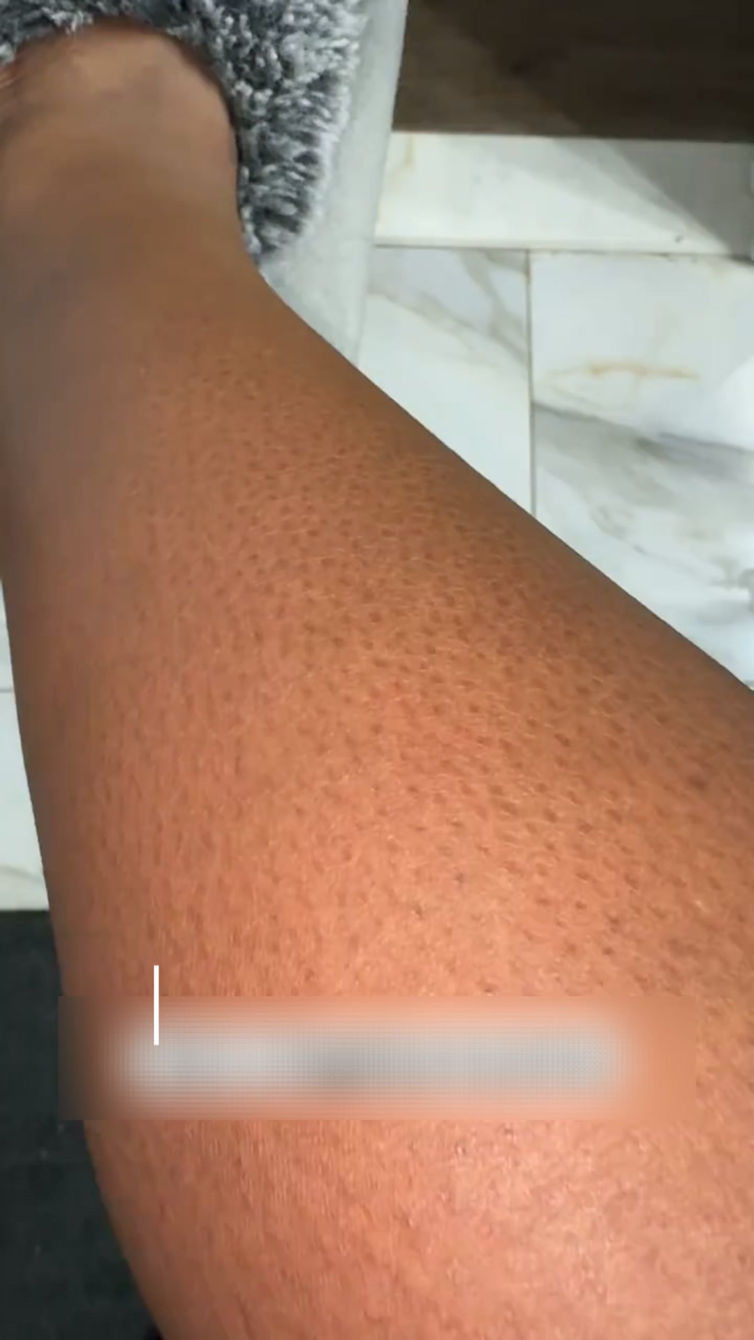 UNA PIEL SUAVE Y SEDOSA EMPIEZA AQUÍ