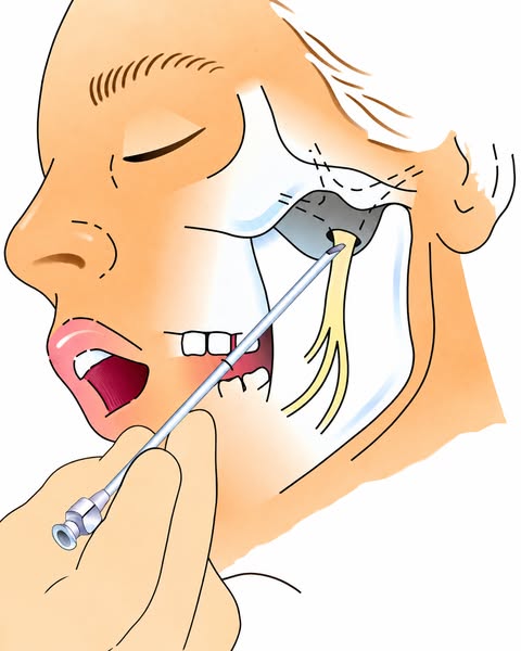 Read This If You Have Migraines