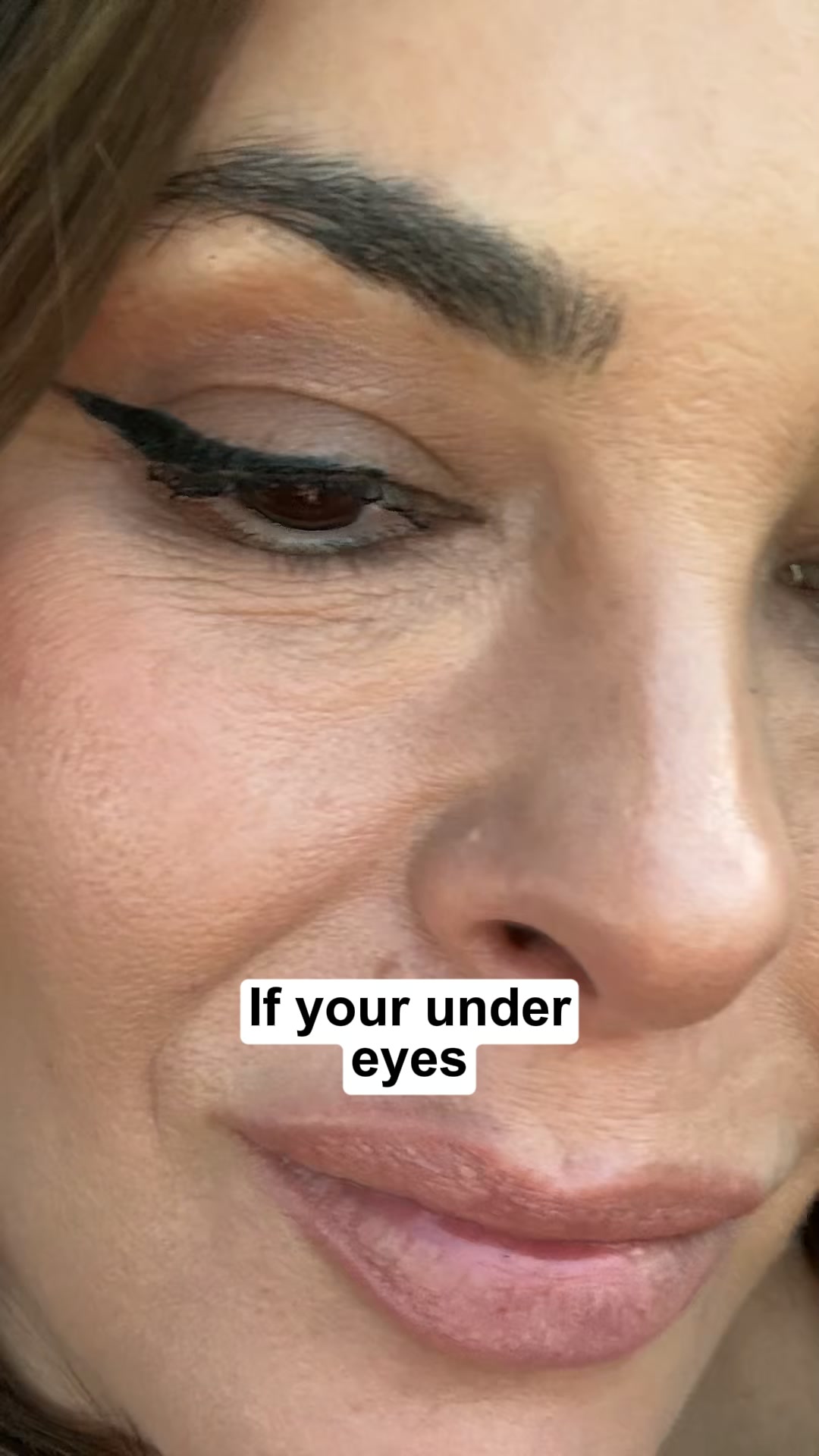 Dry-under eyes? (apply this for 7 days)