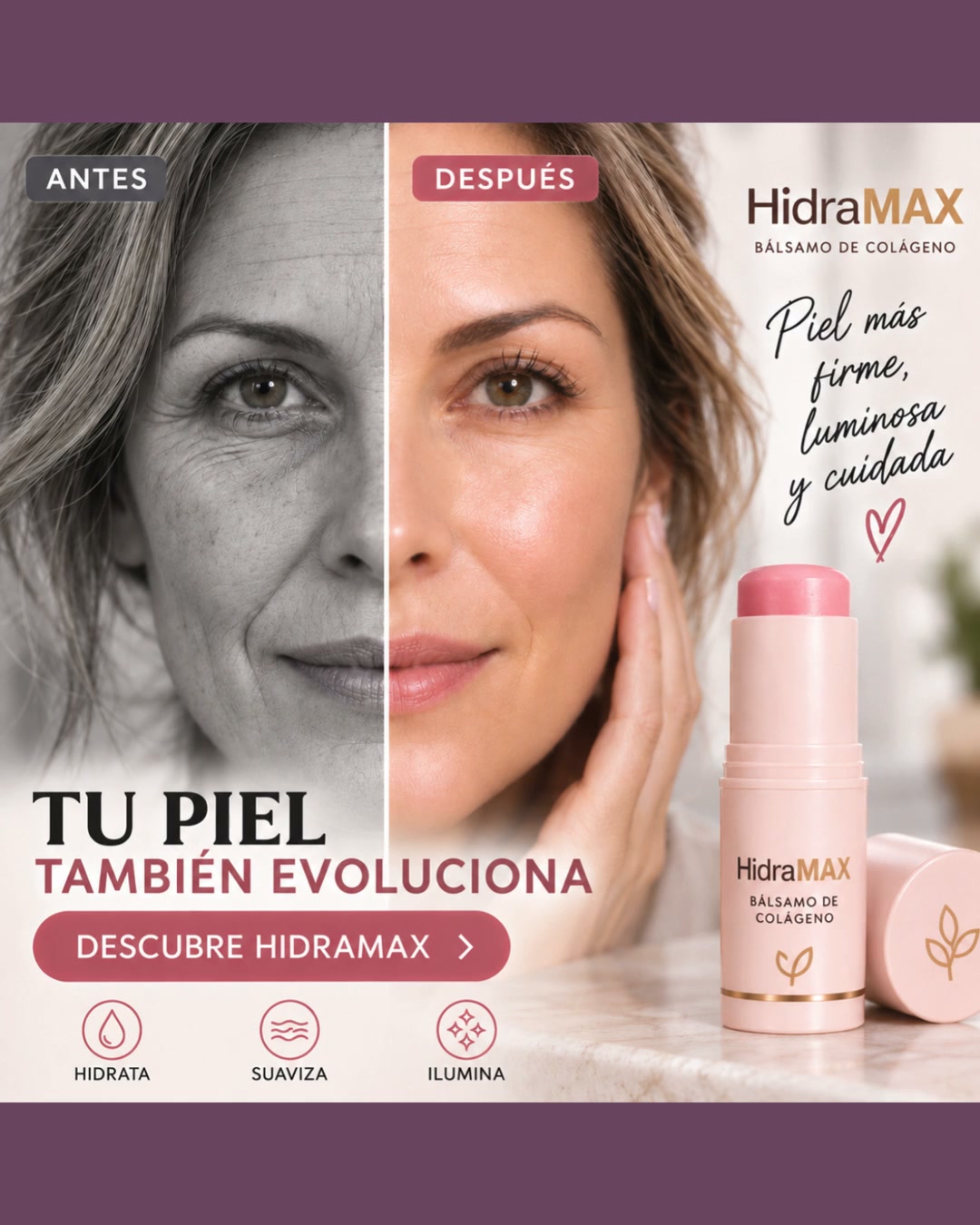 Tu aliado contra las líneas de expresión