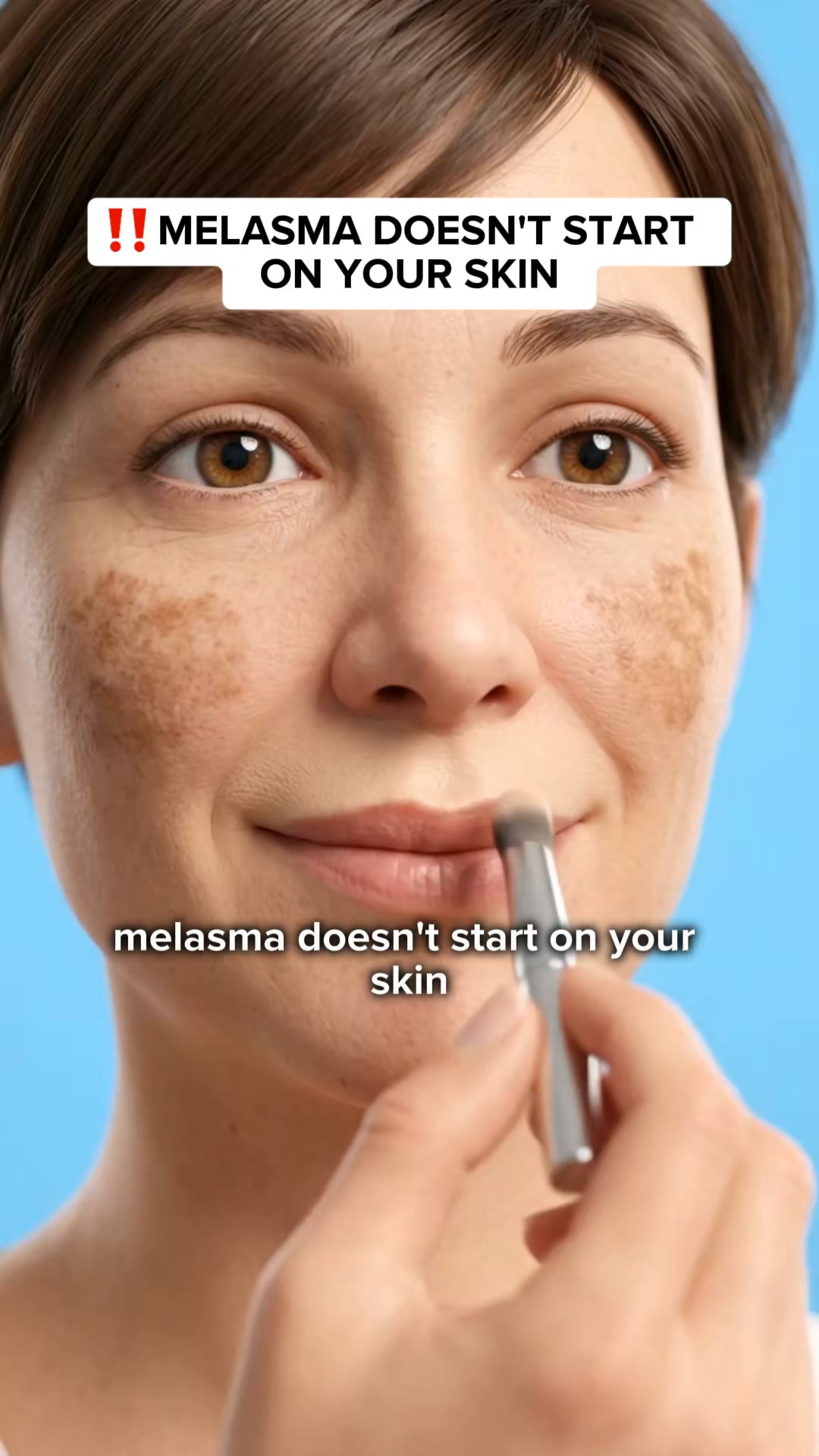 Stop Covering Melasma With Makeup, Do This Instead