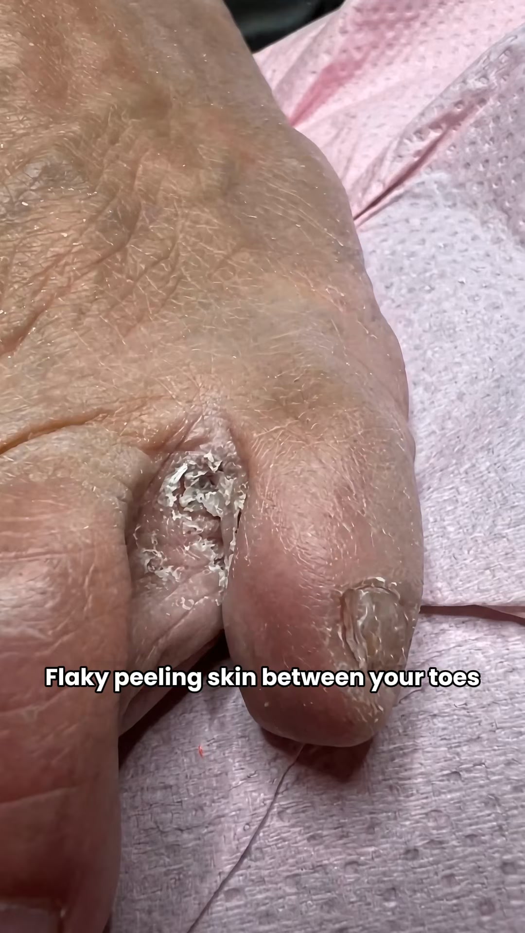 That's Not Dry Skin