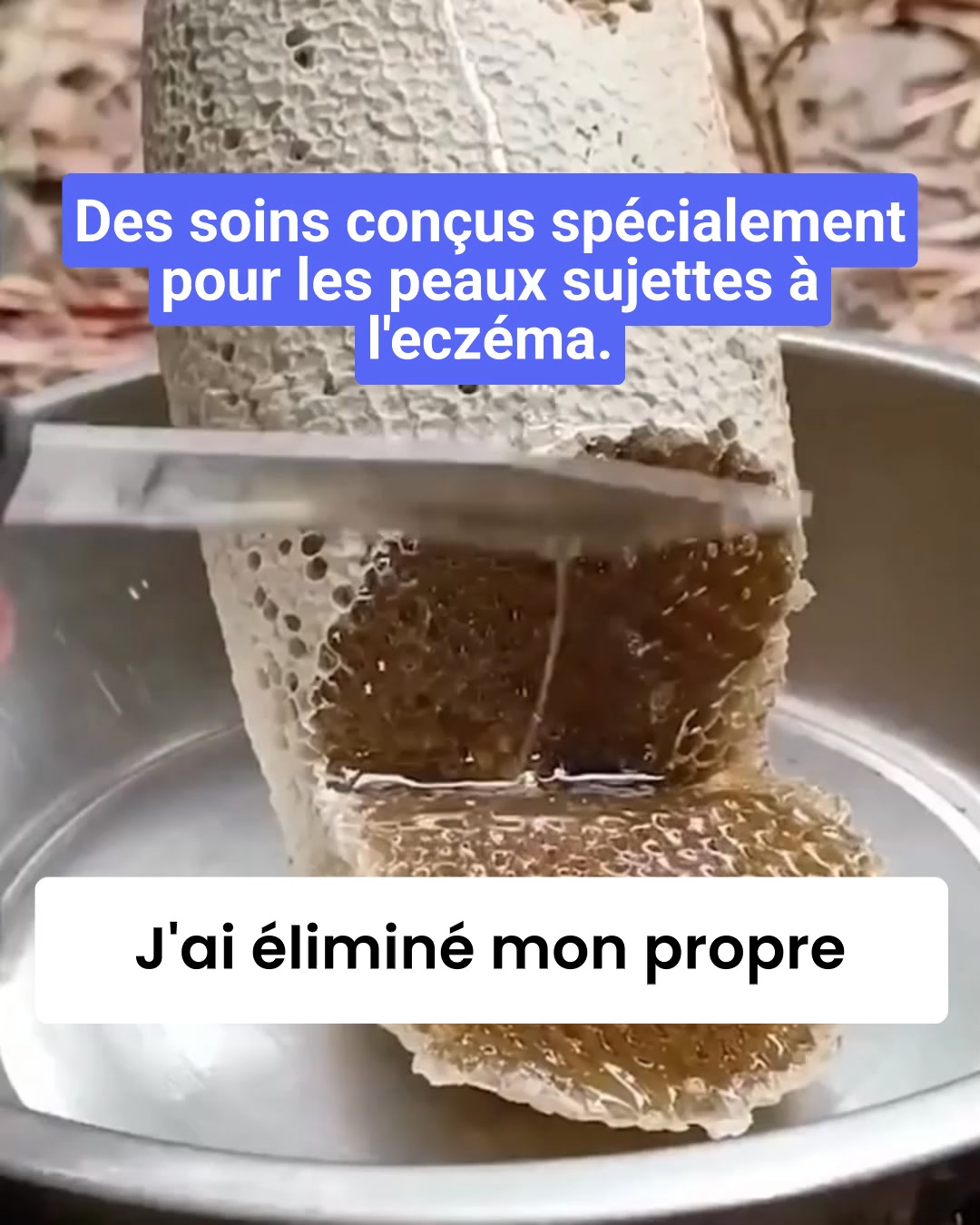 Le baume naturel qui met enfin un terme aux démangeaisons