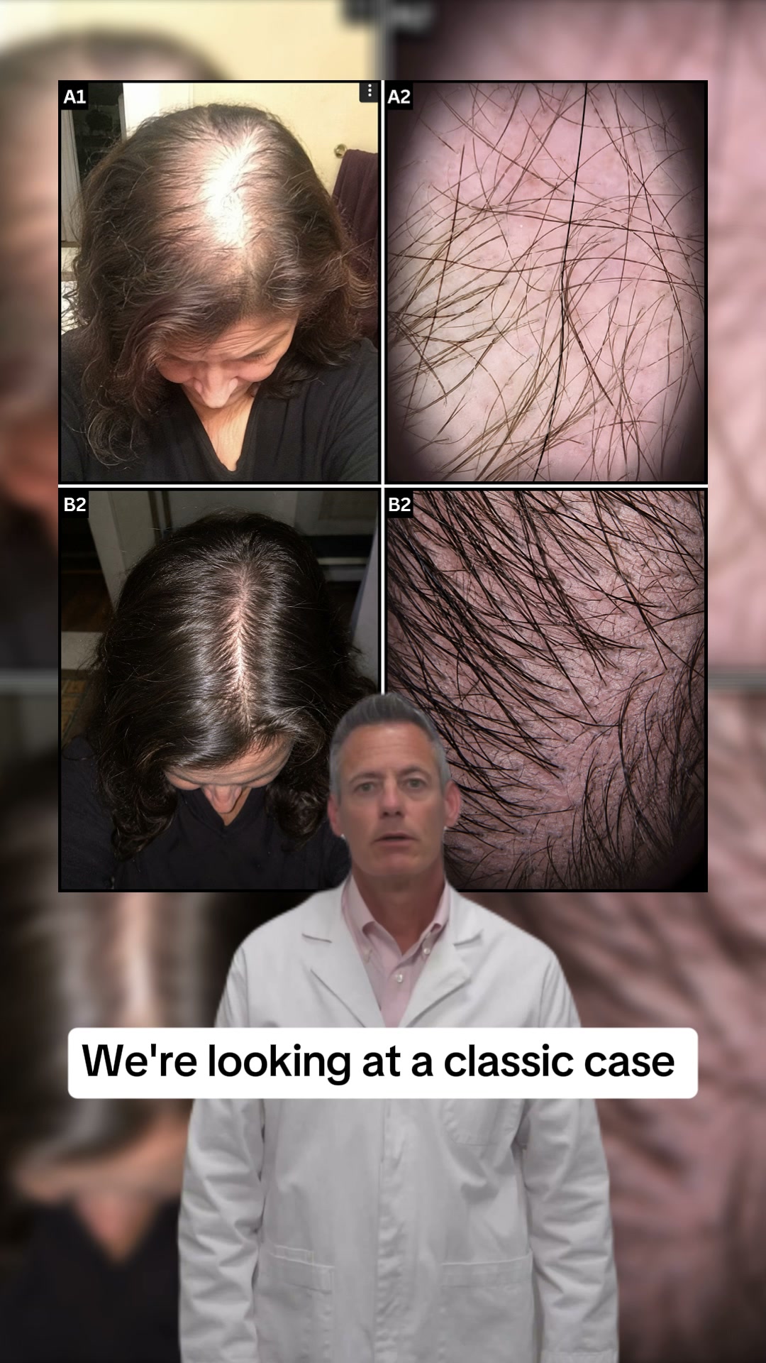 Restore Thick, Beautiful Hair