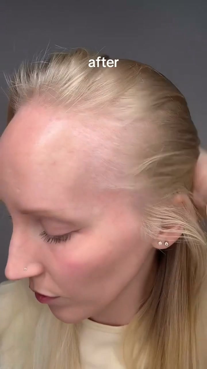 Korean Hair Growth Serum