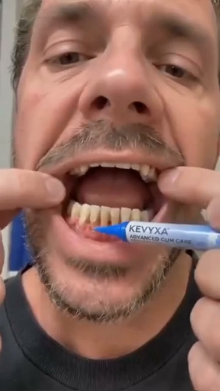 Flash your confident smile again — without the dental drill!