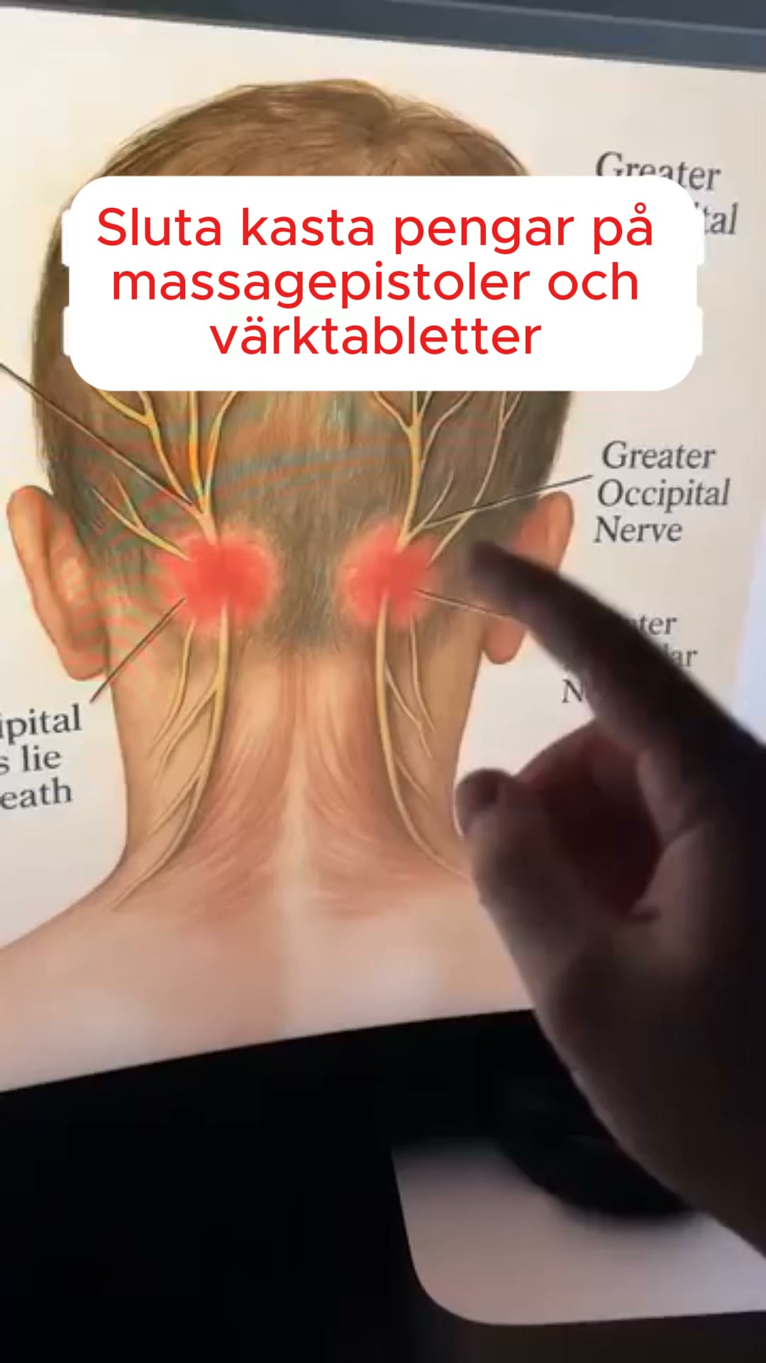 Släpp nacksmärtan på 15 minuter med CerviCare™