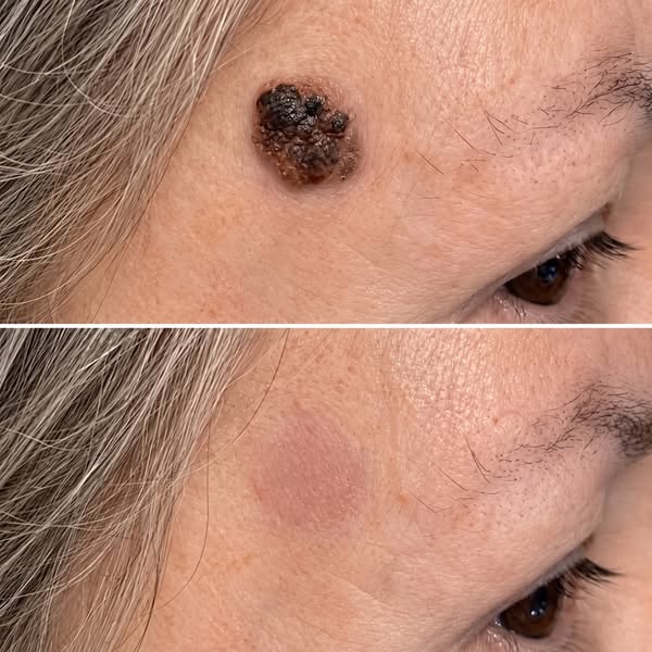 Read this if your age spots keep multiplying.