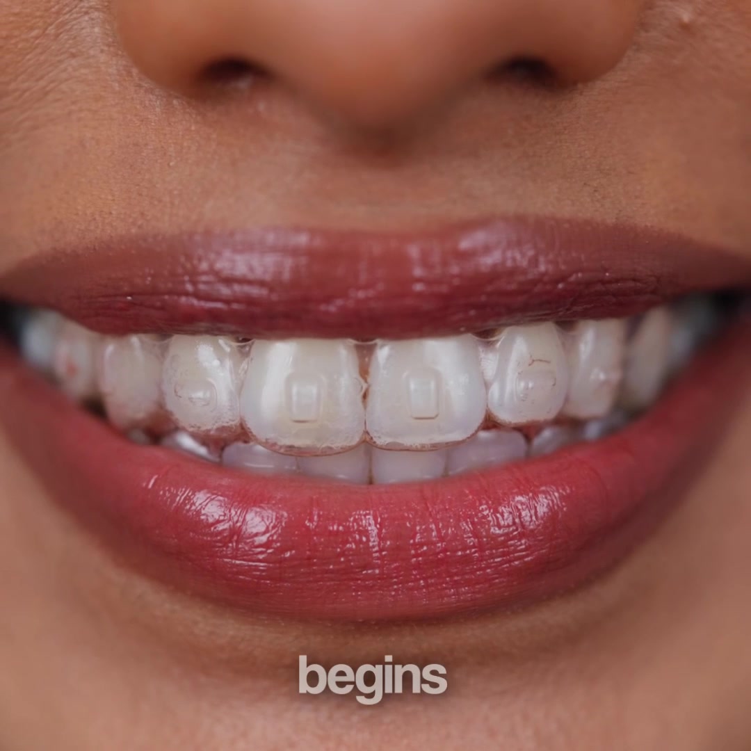 Unlock Your Best Smile Without Fear or Embarrassment