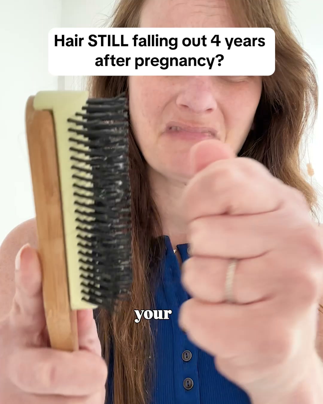 Thicker, Fuller Hair in 4-6 Months