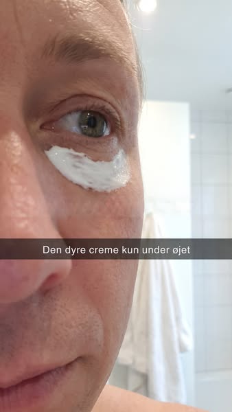 Øjencreme er ikke et lovkrav