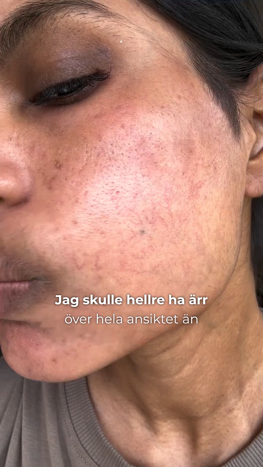Prova riskfritt i 60 dagar!