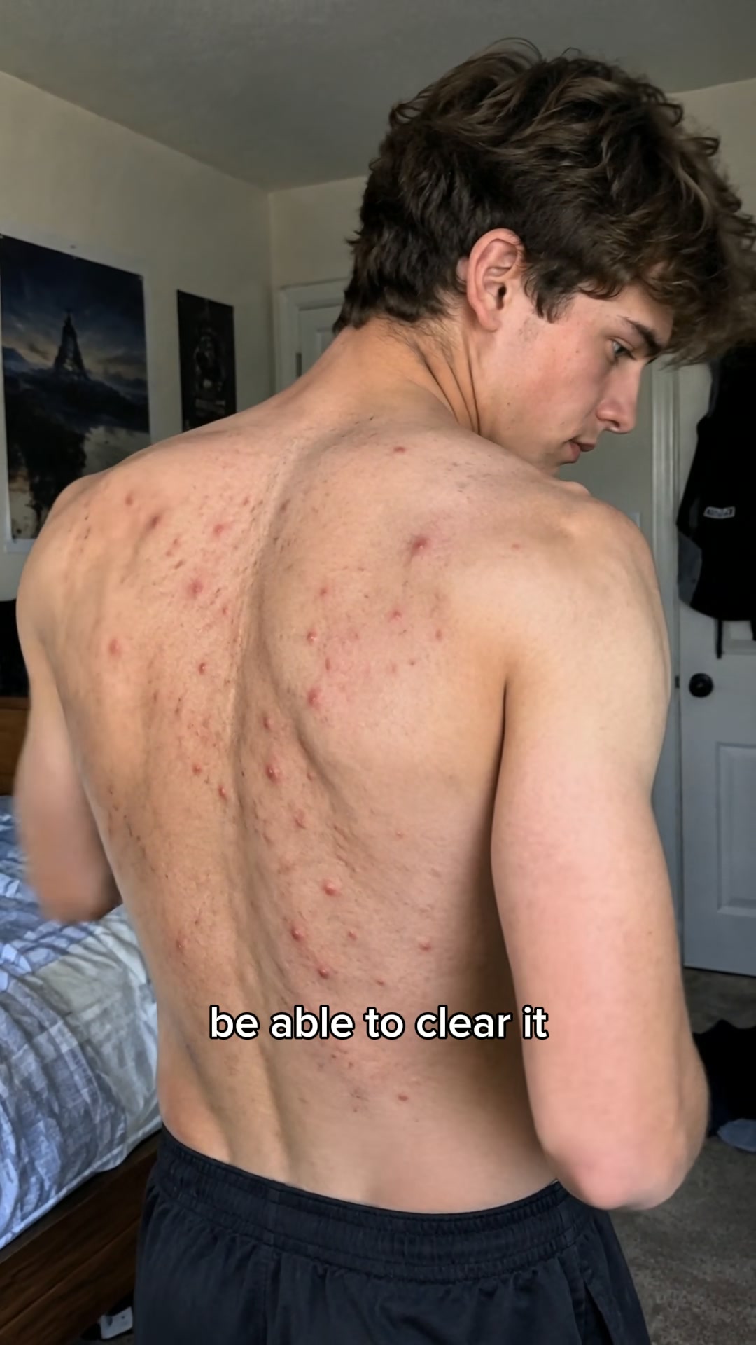 Built for Body and Back Skin.