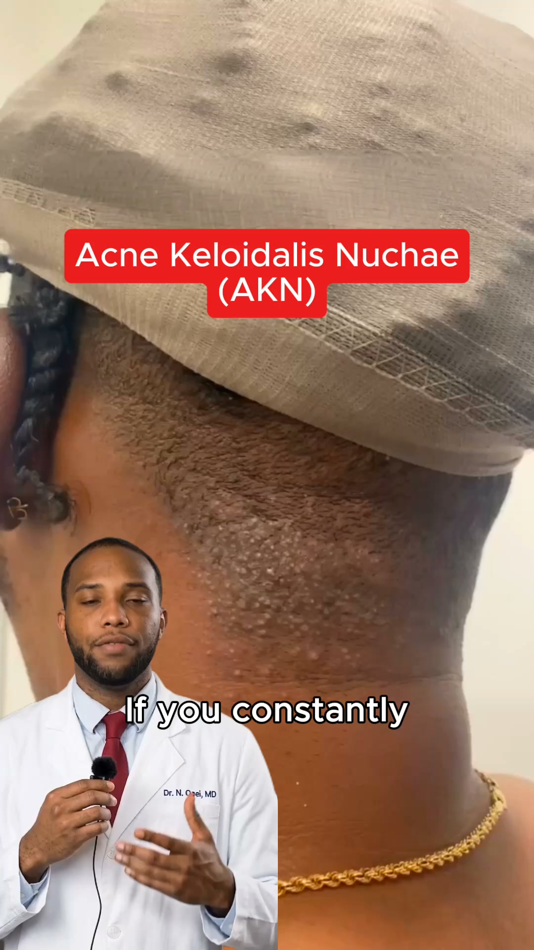 Fix Your AKN. Start Now.