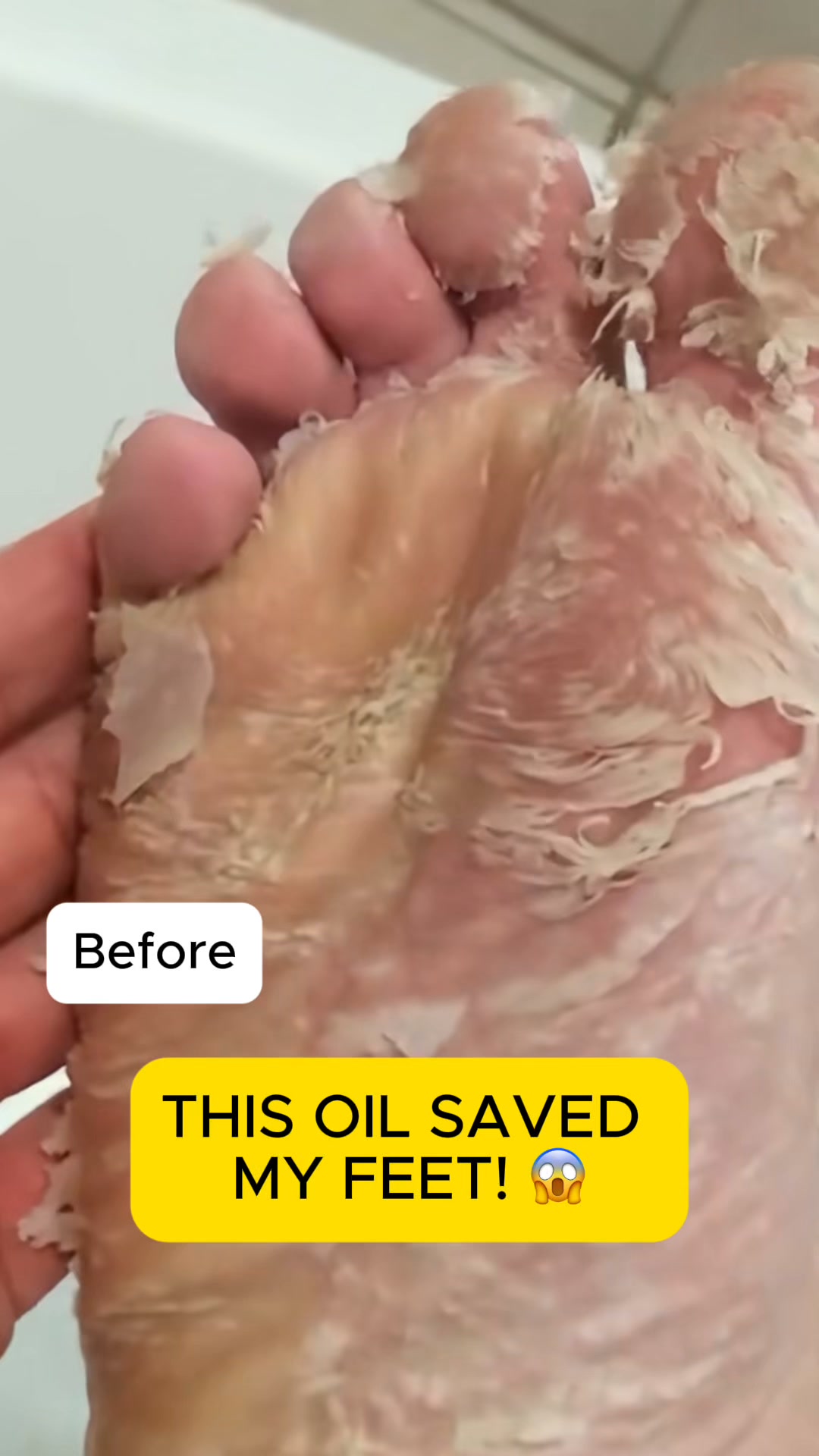 Watch Rough Buildup Start to Shed