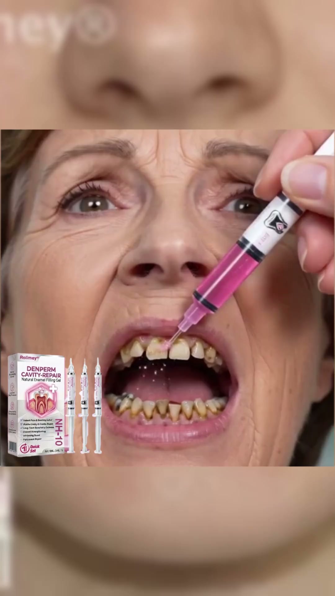 Cavity Repair FDA-Recognized 10% Nano-Hydroxyapatite (NH-10) | Delivery within 2-4 working days | Full refund guarantee