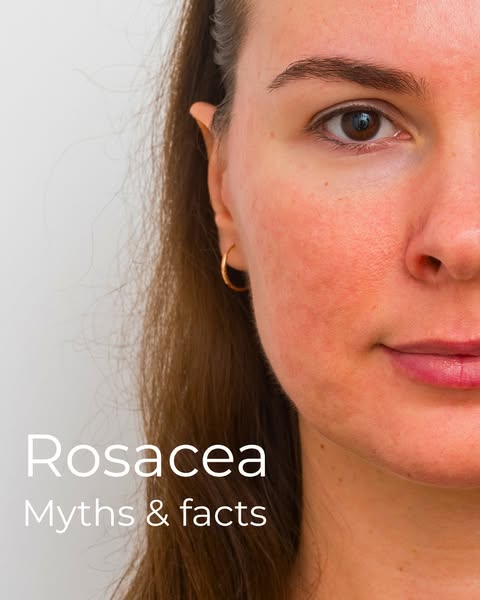 Discover our Rosalique Range