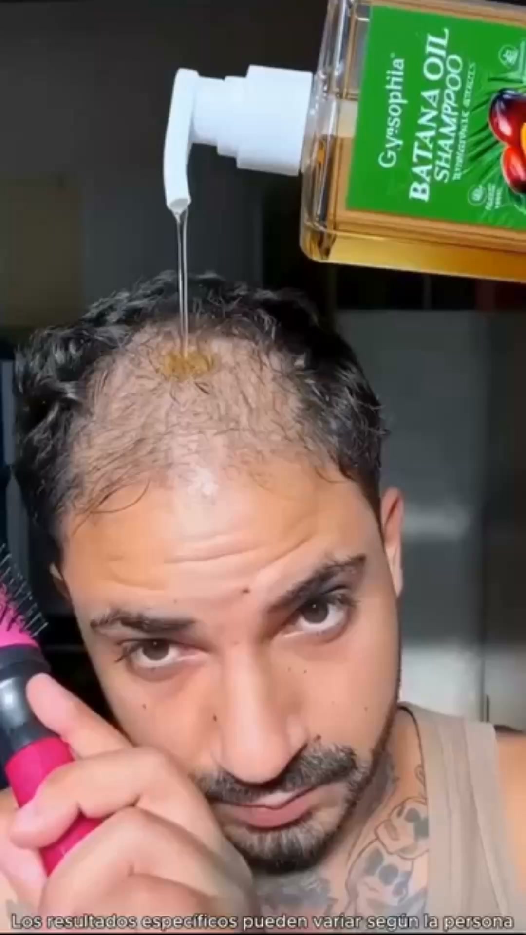 ⁠¿Cada Vez Encuentras Más Pelo En La Ducha?
