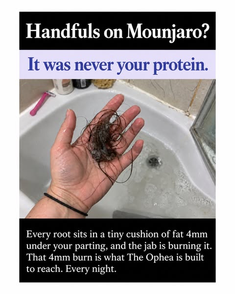 Still shedding on Mounjaro? Read this
