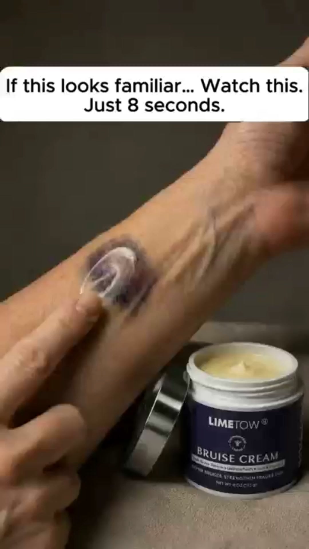The Truth About "Miracle" Bruise Creams