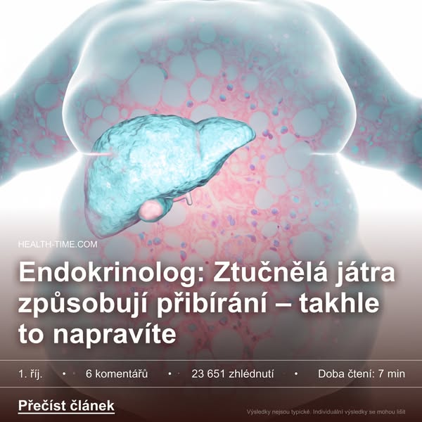 Ztučnělá játra vám brání zhubnout. Takhle to konečně změníte
