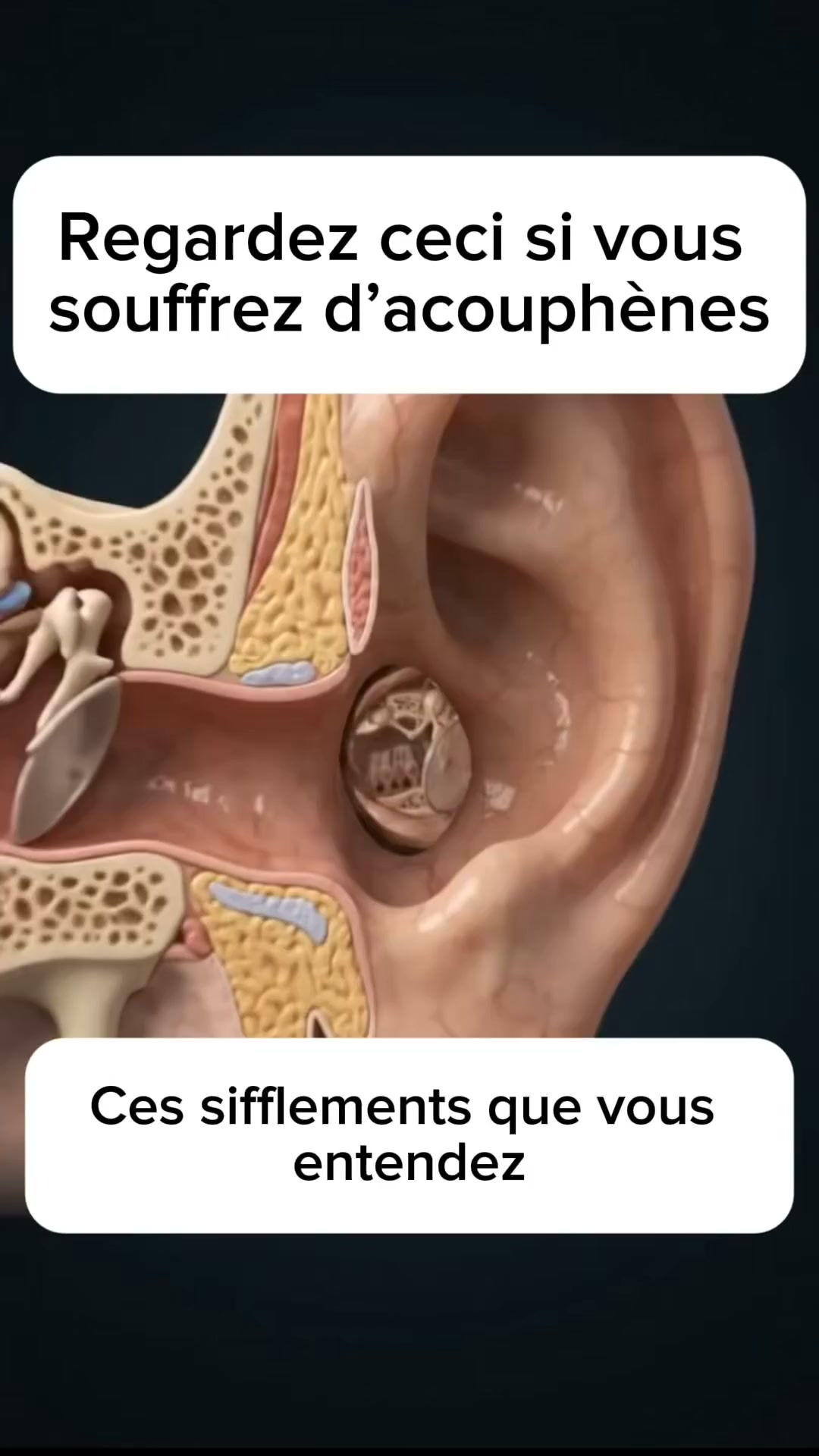 Dose clinique d'Astaxanthine — 100% naturel, 100% résultats