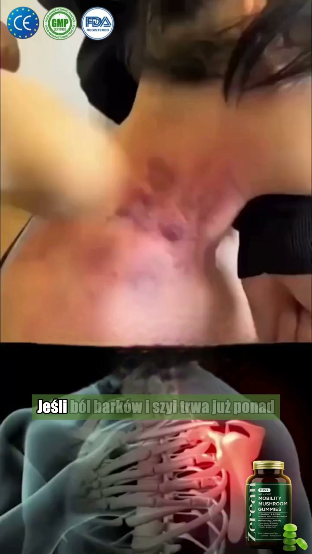Gorąco polecany przez chirurgów ortopedów – wysoce skuteczny.
