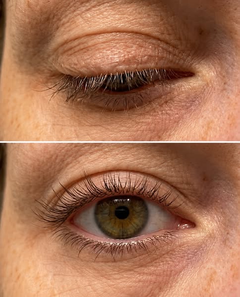 See why women are raving about this Korean Lash Serum