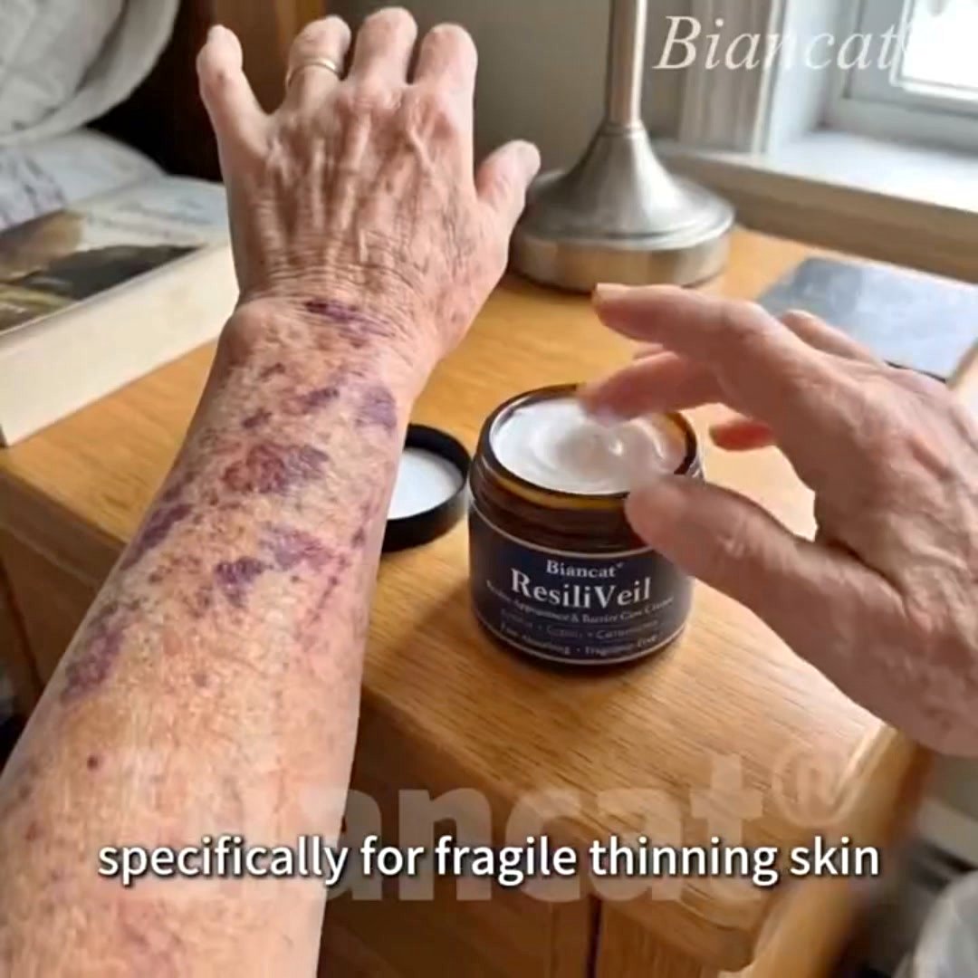 Stubborn Bruises? Try This 5-Minute Remedy