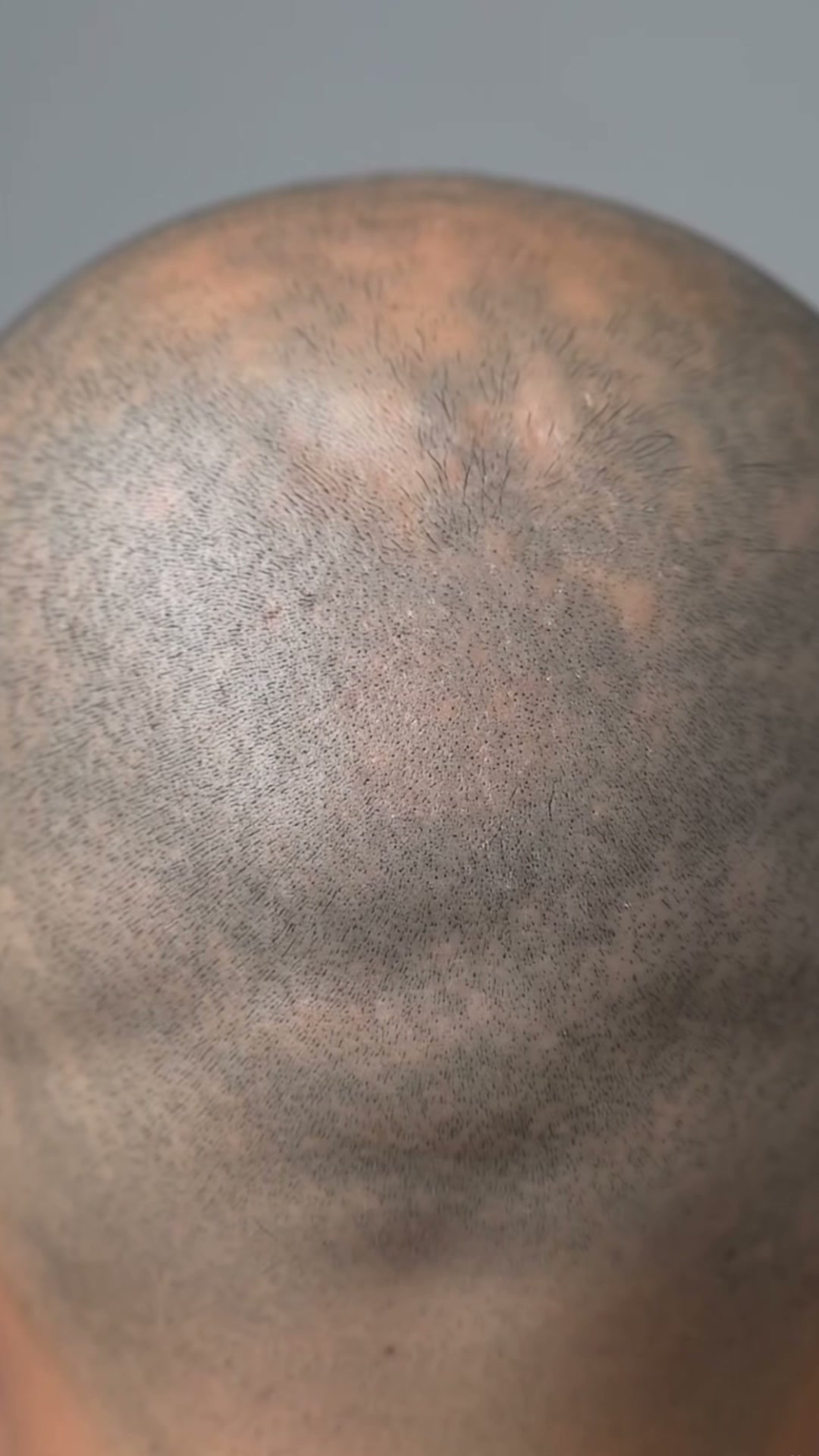 Cabello Más Abundante y Fuerte