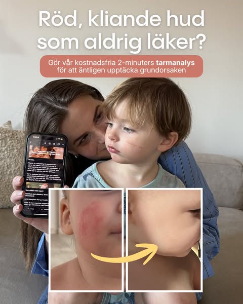 Gratis rapport om tarmhälsa