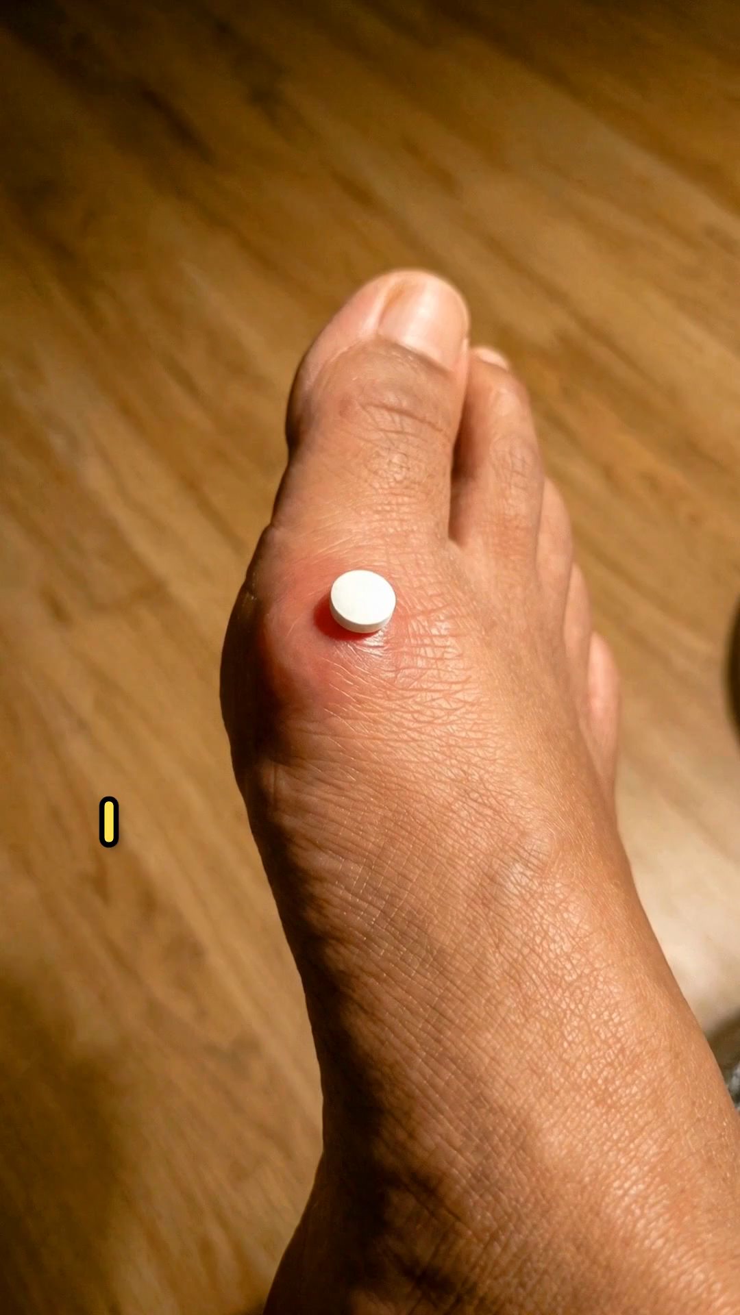 Bunion Relief Without a Pill Every Night