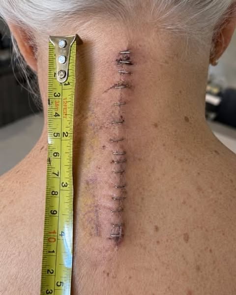 Read this if your neck pain is ruining your life