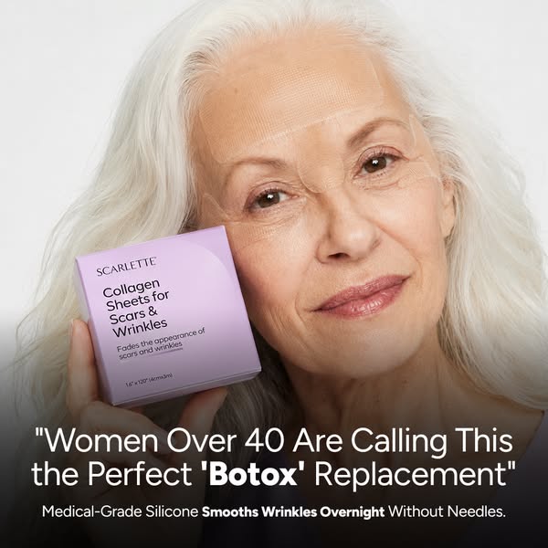 I Cancelled My Botox. Here's Why.