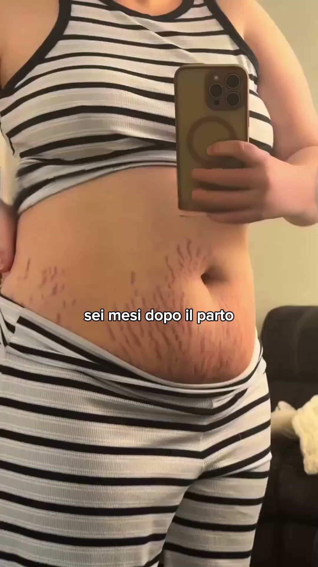 Spedizione Gratuita