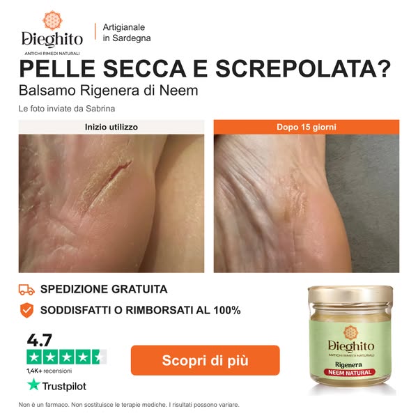 Piedi ruvidi e screpolati? Prova il Balsamo Rigenera