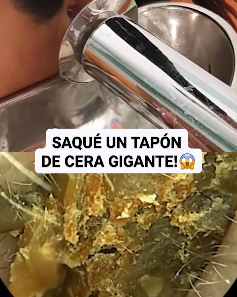 CONTRAREEMBOLSO
