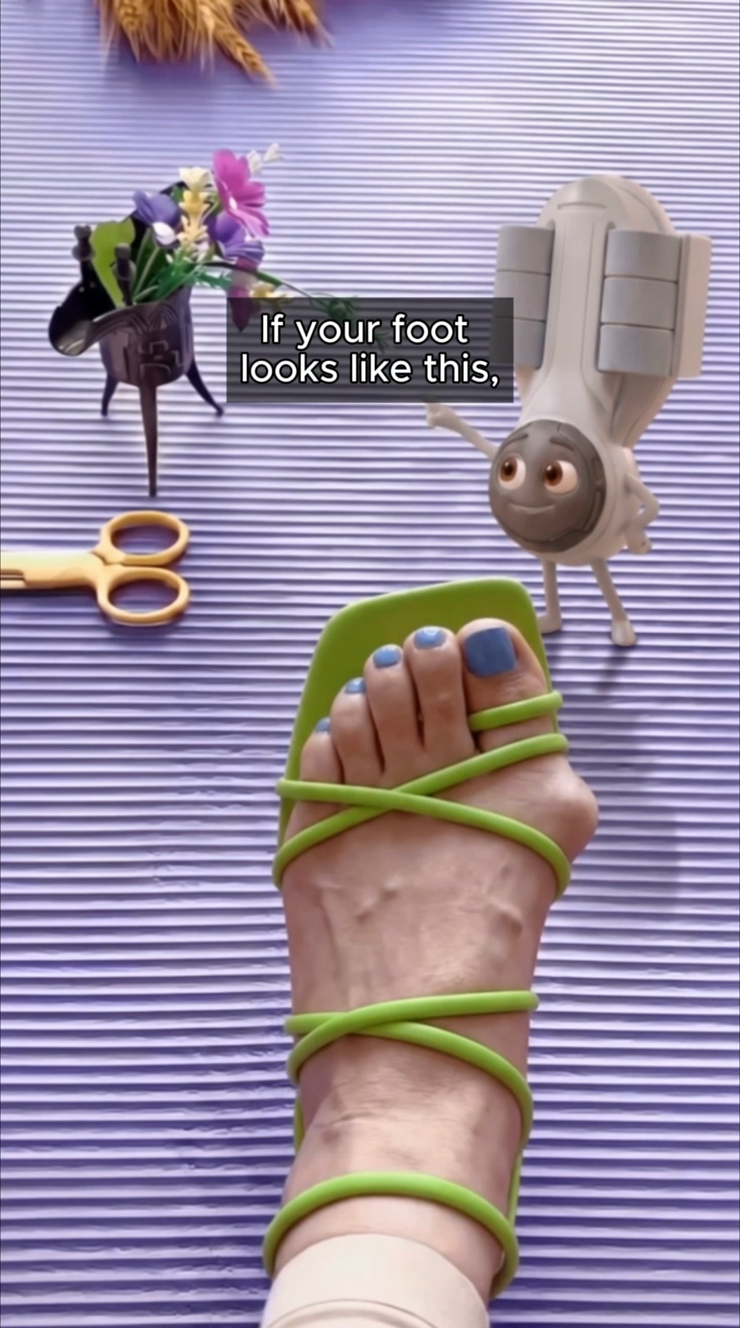 Fix Your Bunions Without Surgery