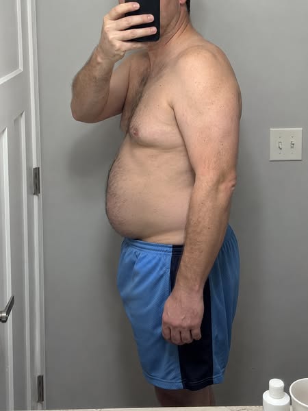 Fatty liver killed my brother. I reversed mine in 8 weeks.