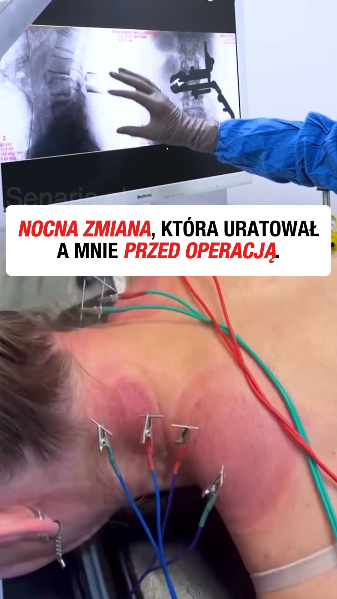 Przeczytaj, jeśli ból szyi nie ustępuje...