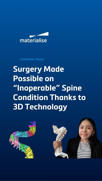3D Tech Saves "Inoperable" Spine Case