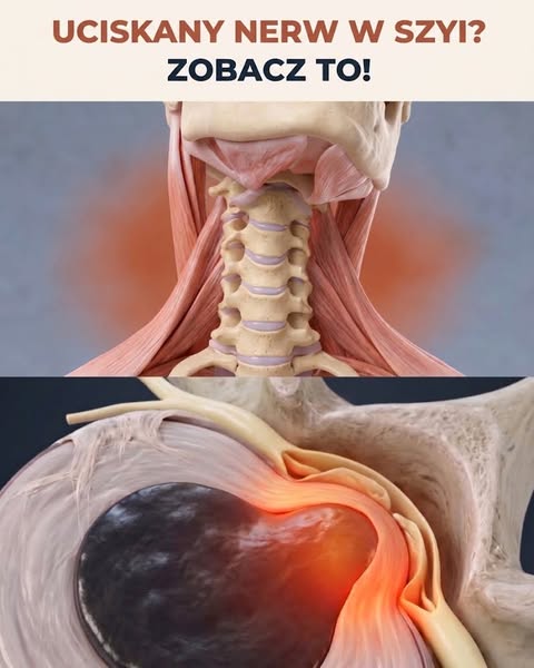 Dlaczego Twój kark jest ciągle napięty, mimo że próbujesz wszystkiego.
